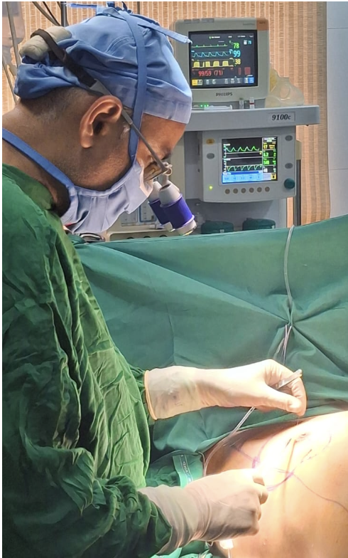 Dr. Chintan Patel - Operating Breast Tumour 